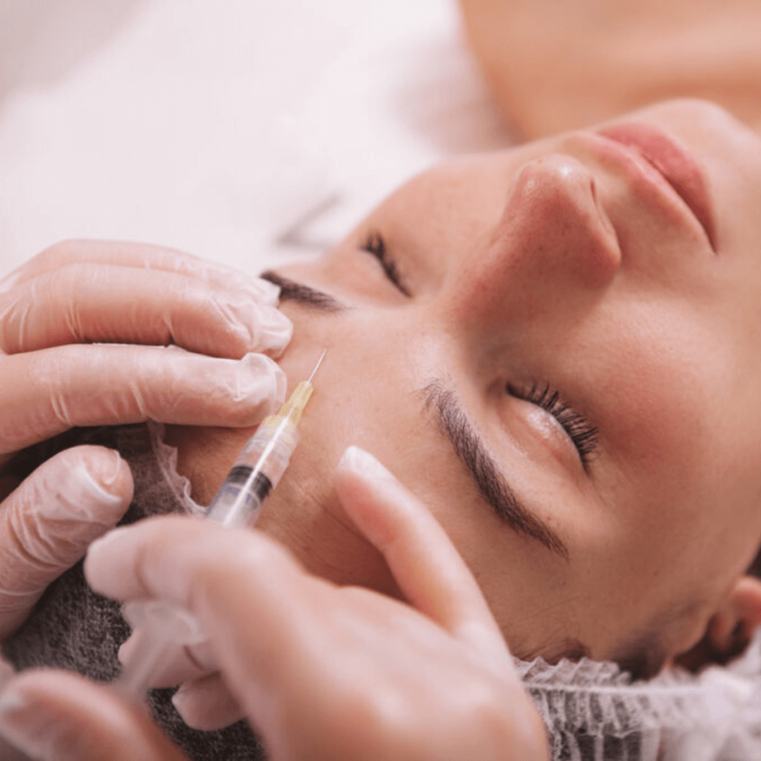 preenchimentofacial2 preenchimentofacial2